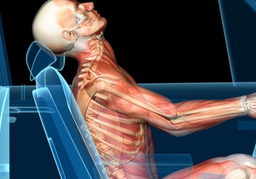 Is whiplash considered a serious injury?