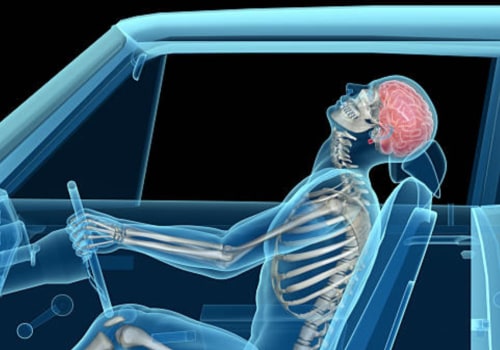 Can Whiplash be Treated Years Later?