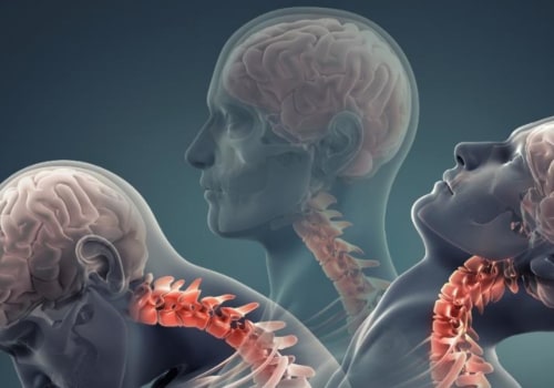 Can Whiplash Cause Neurological Problems Years Later?